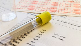 Come chiedere l’esenzione ticket e chi ne ha diritto