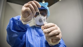 Covid, i farmaci da assumere subito: dall’aspirina all’Aulin, la cura domiciliare di Remuzzi