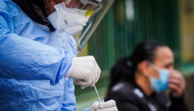 Cos’è la “lingua Covid”: come si manifesta e come riconoscerla