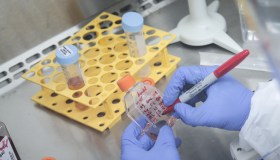 Omicron 2, primi casi in Italia: dove e cosa sappiamo dall’indagine Iss