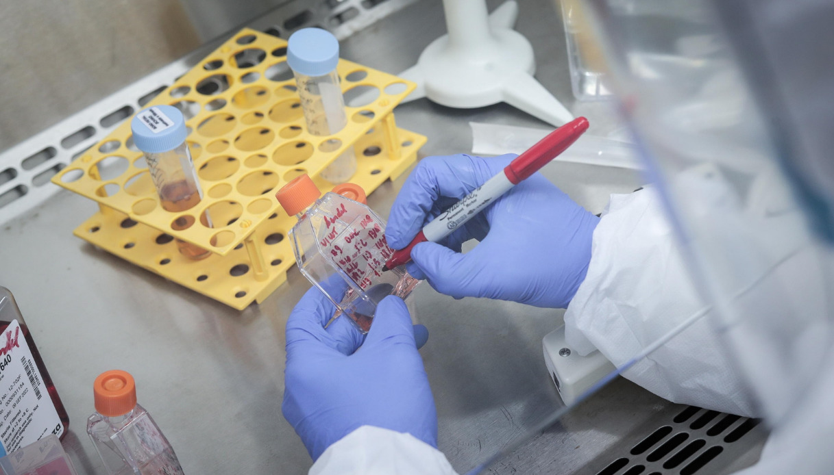 Variante Xe in Italia: i sintomi a cui fare attenzione