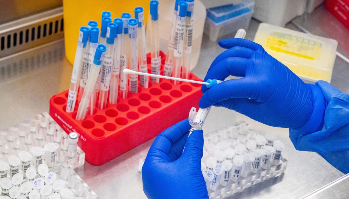 Long Covid, trovato il gene legato alla sindrome post infezione