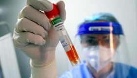 Non solo Covid: dai superbug ai “virus climatici”, le nuove malattie che dovremo combattere nel 2024