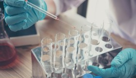 Peste bubbonica trasmessa dal gatto, caso su un uomo negli Stati Uniti: quali sono i sintomi