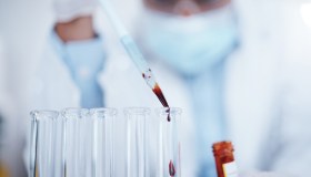 Microplastiche, gli impatti nocivi sulla salute umana