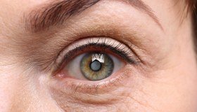 Cataratta, cos’è, come si cura e quando sottoporsi all’intervento